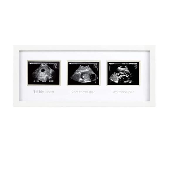 Trimester Progression Sonogram Picture Frame, Milestone Keepsake  Photo Frame - Picture 1 of 6